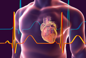 Electrocardiograma